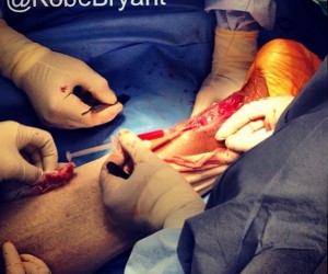 Twitpic – La photo trash de Kobe Bryant et son opération du tendon d’Achille